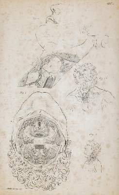 Bild Nr.1: 144-1365 Froriep,R.: (Medizin)