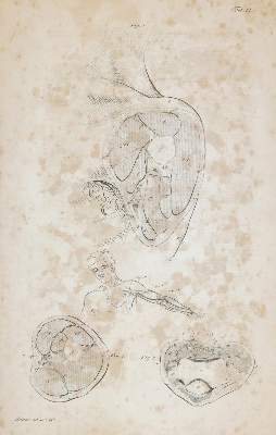 Bild Nr.3: 144-1365 Froriep,R.: (Medizin)