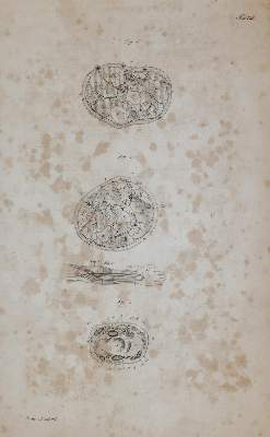 Bild Nr.4: 144-1365 Froriep,R.: (Medizin)