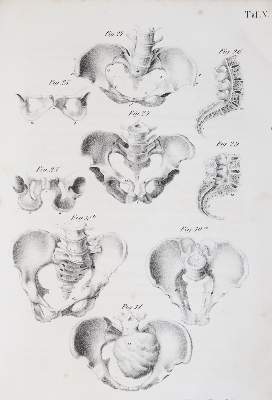 Bild Nr.2: 144-1370 Busch,D.W.H.: (Medizin, Gynäkologie)