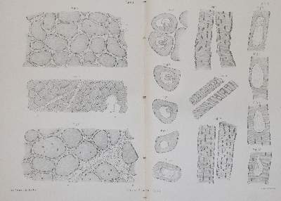 Bild Nr.13: 144-1372 Siebold,E.C.J.v.: (Medizin, Gynäkologie)