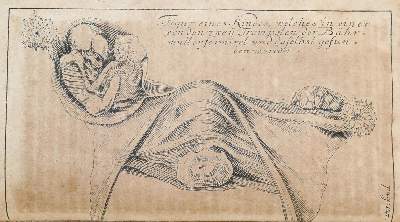 Bild Nr.2: 144-1373 Timme,J.: (Medizin, Gynäkologie)