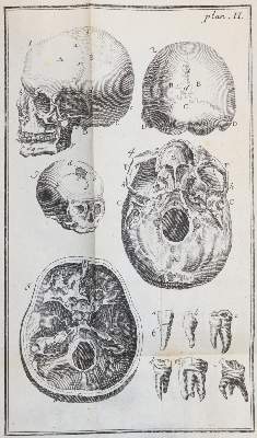 Bild Nr.3: 144-1409 Noguez,(P.N.).: (Medizin)
