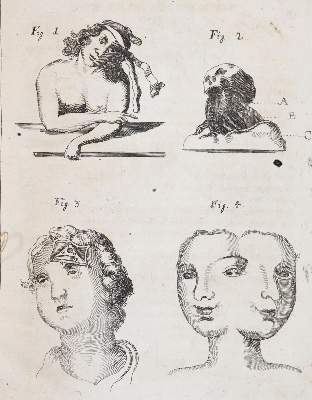Bild Nr.3: 144-1437 Valentini,M.B.: (Medizin)
