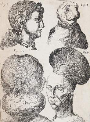 Bild Nr.4: 144-1437 Valentini,M.B.: (Medizin)