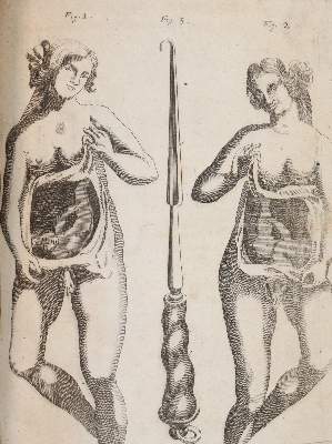 Bild Nr.6: 144-1437 Valentini,M.B.: (Medizin)