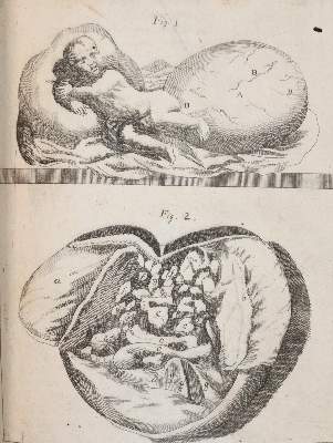 Bild Nr.7: 144-1437 Valentini,M.B.: (Medizin)