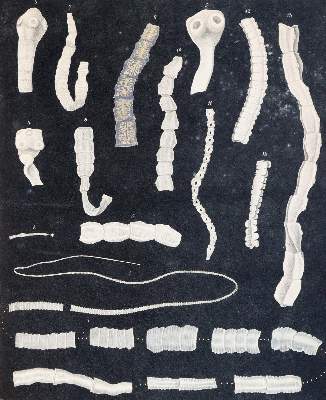 Bild Nr.3: 144-1441 Bremser,(J.G.).: (Medizin, Würmer)