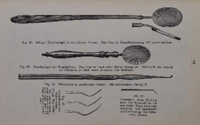 Bild Nr.3: 144-1443 Kronenbrecher,J.: (Medizin, Zahnheilkunde)