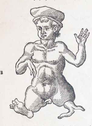Uffenbach,P. – Thesaurus chirurgiae, continens praestantissimorum autorum opera chirurgica