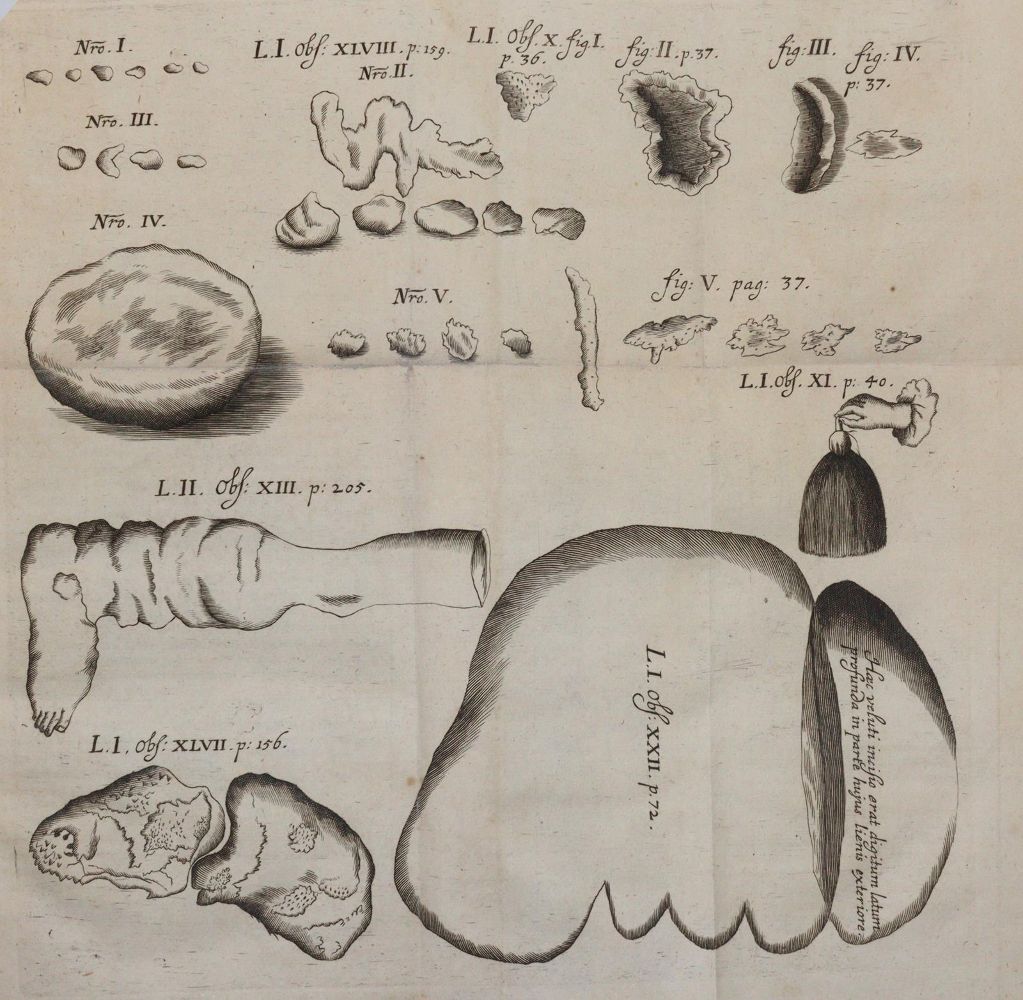 Große Abbildung Nr.2: 145-1432 Wolf,I.: (Medizin, Chirurgie)