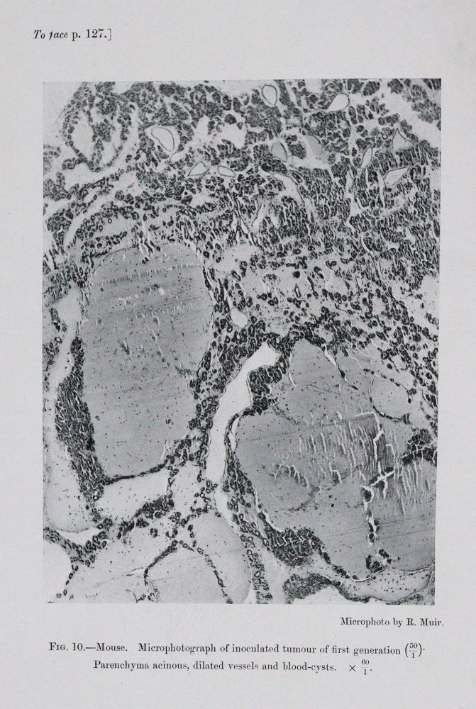 Große Abbildung Nr.4: 145-1464 Bashford,E.F. (Hrsg.).: (Medizin, Krebs)