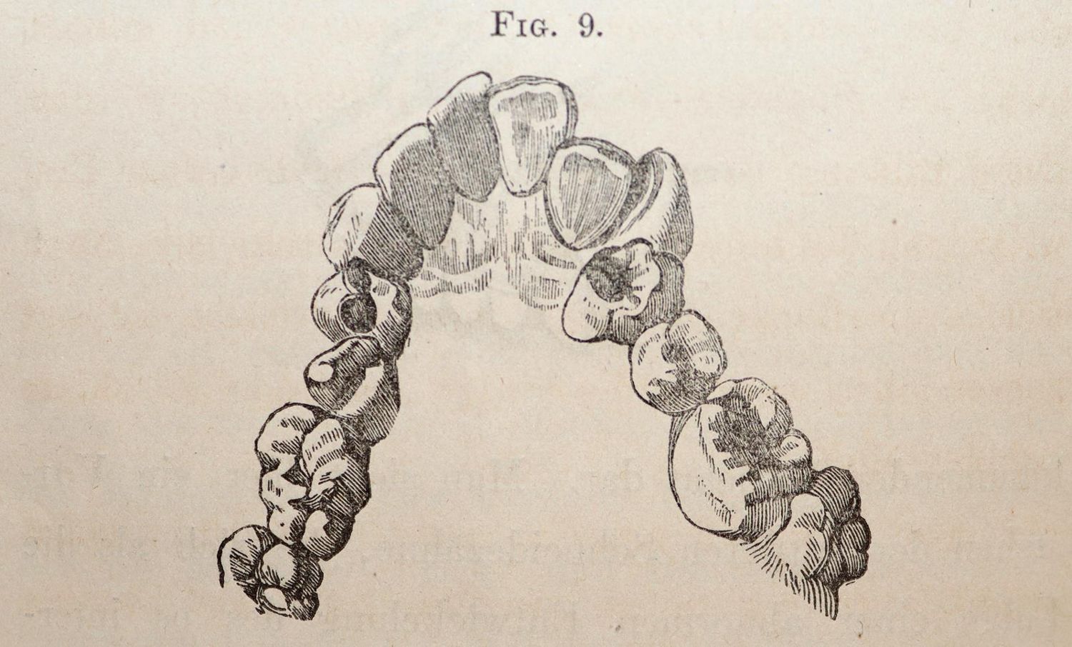 Große Abbildung Nr.3: 145-1490 Sewill,H.: (Medizin, Zahnheilkunde)