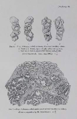 Bild Nr.2: 145-1464 Bashford,E.F. (Hrsg.).: (Medizin, Krebs)