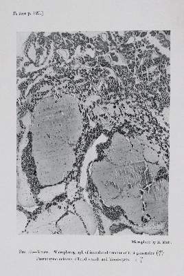 Bild Nr.4: 145-1464 Bashford,E.F. (Hrsg.).: (Medizin, Krebs)